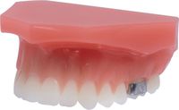 Orthodontic demonstration model tomas®/amda®